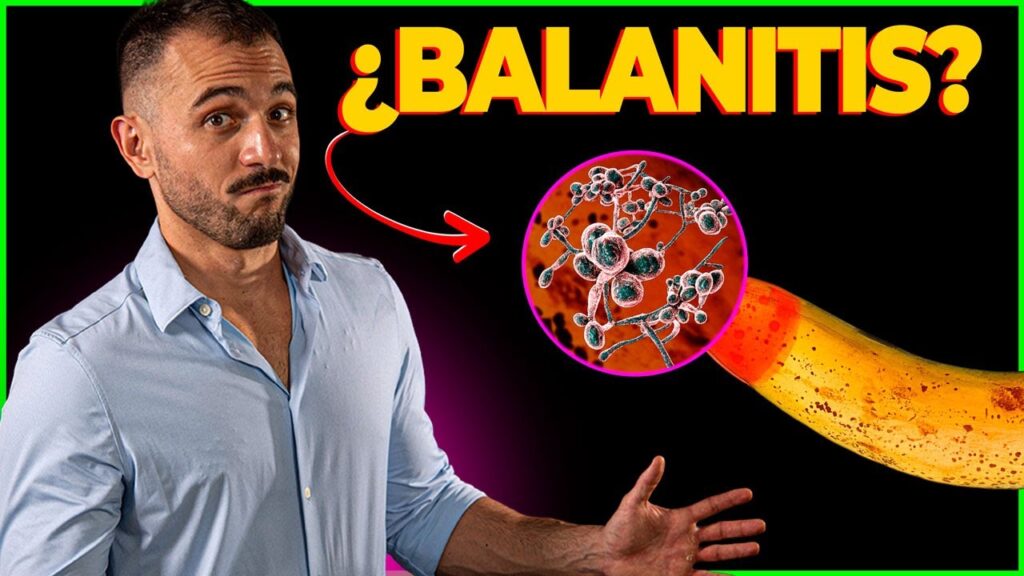 Balanitis por hongos: causas, síntomas y tratamiento