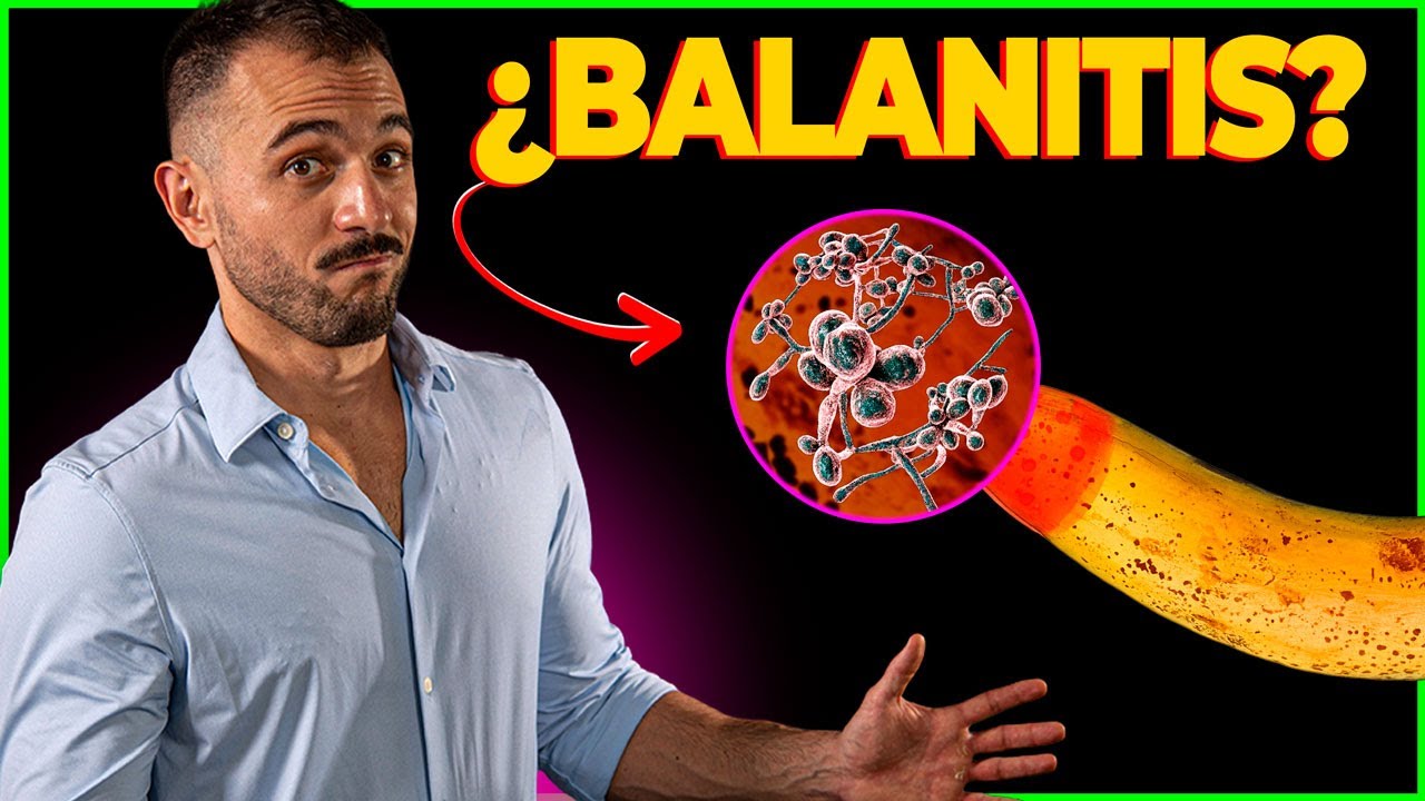 Balanitis por hongos: causas, síntomas y tratamiento