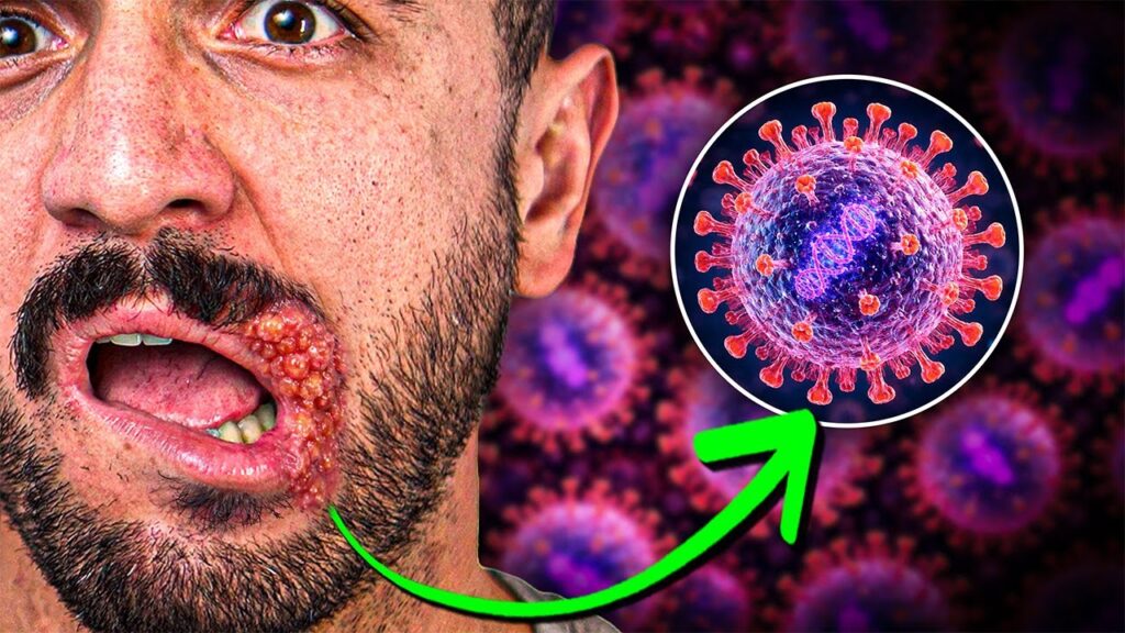 Herpes genital: síntomas, tratamiento y convivencia