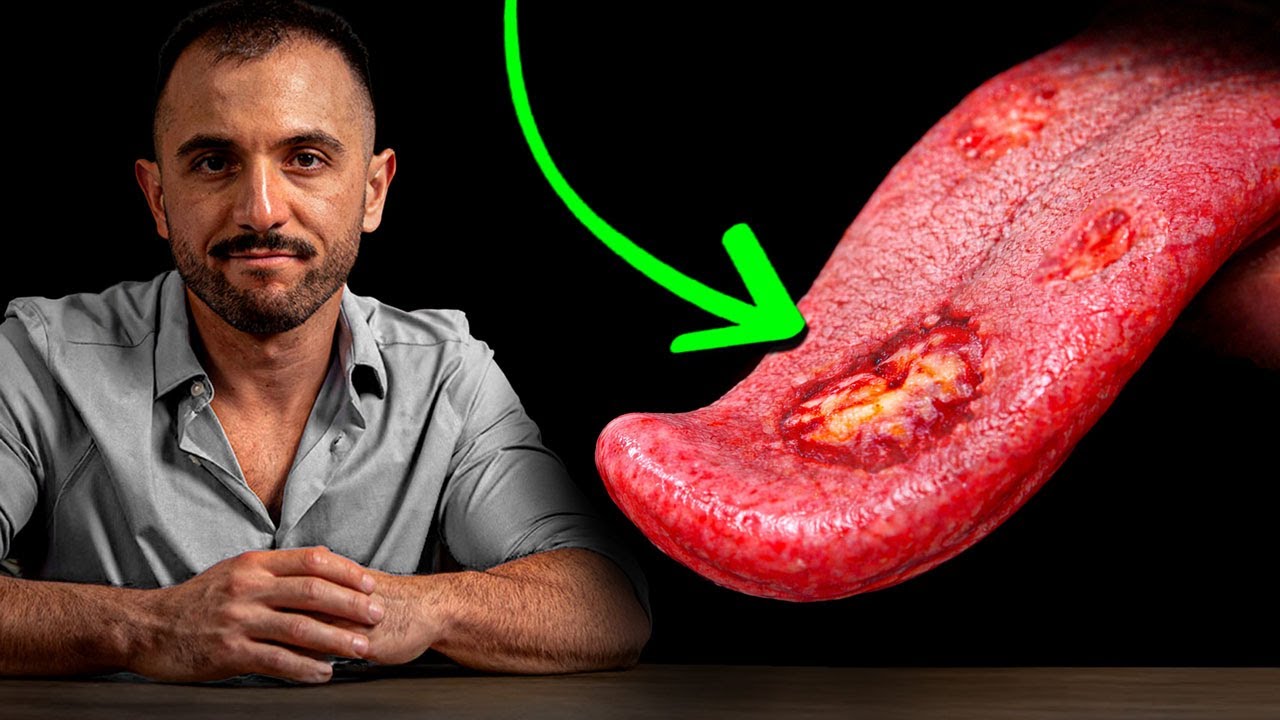 Sexo oral e infecciones: riesgos reales y como protegerte