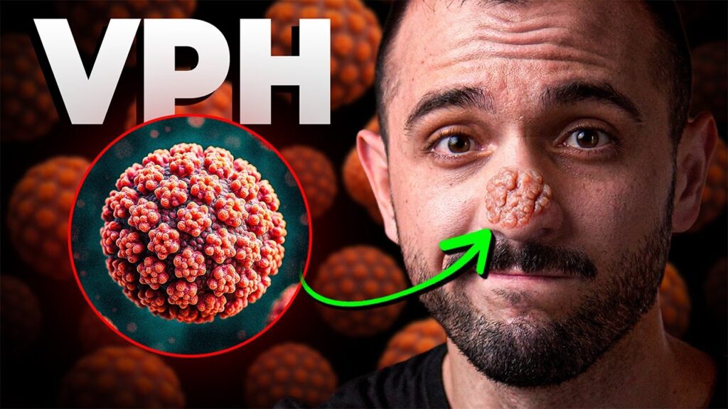 VPH en hombres: síntomas, riesgos y vacuna