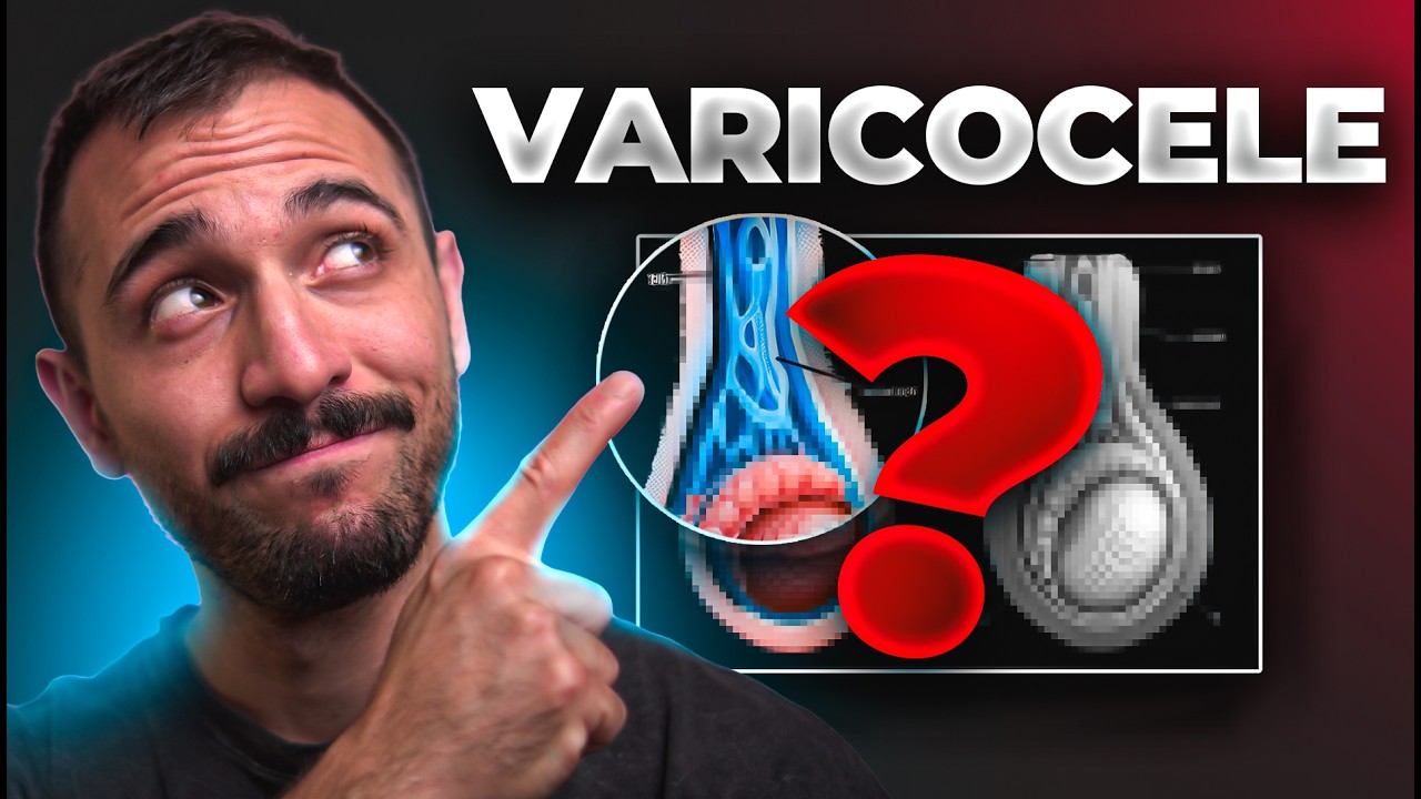 Varicocele: qué es, diagnóstico y cuándo operar